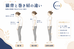 猫背と巻き肩の違いとは？見分け方や改善方法をご紹介